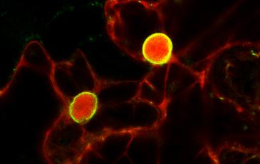 Microscopic photo of red and green fluorescent protein labels on nuclear envelope