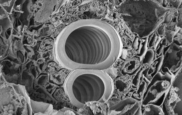 An electron micrograph of the protoxylem in maize