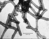 Electron micrograph of BSMV virions