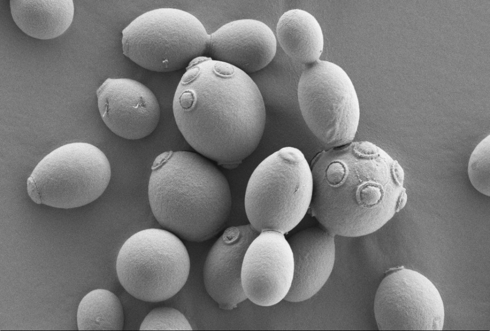 saccharomyces cerevisiae electron microscope